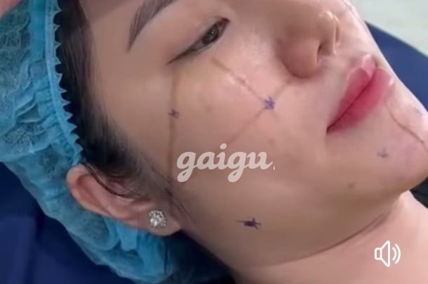 Hót Ngọc Tuyền